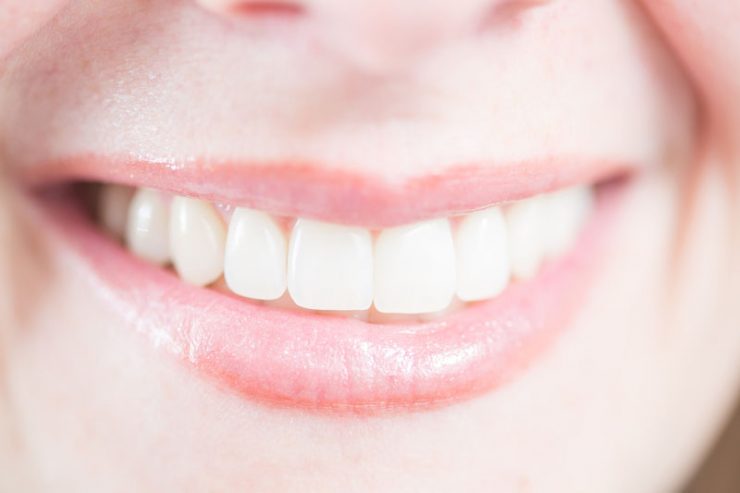 Perfekte, weiß, strahlende Frauenzähne
